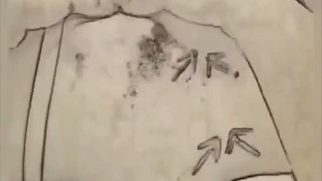 оздоровительный массаж