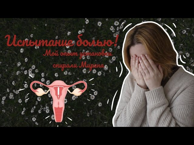 3 недели Боли! Мой честный опыт установки спирали Мирена