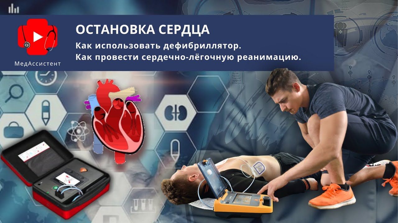 Как использовать дефибриллятор. Что делать в случае остановки сердца