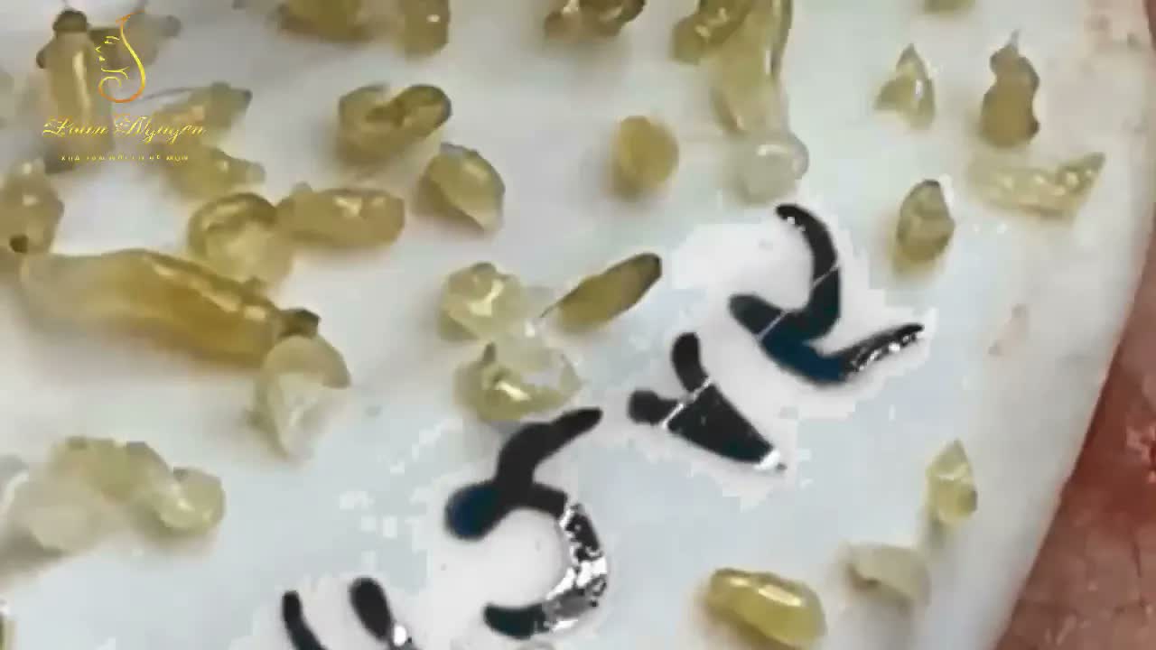 Relax squeezing out blackheads 3 Черные точки