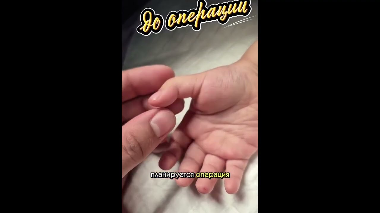 Болезнь Нотта у детей — это не просто «щелчок» пальца