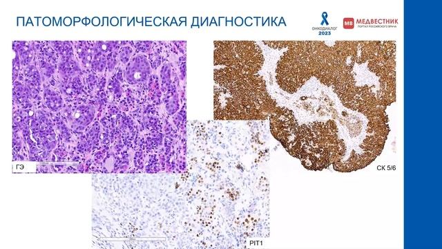 59bf37ee36f722ba336414ed8234f072