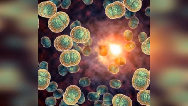 ГОНОРЕЯ: Острая форма Хроническая форма симптомы осложнения последствия