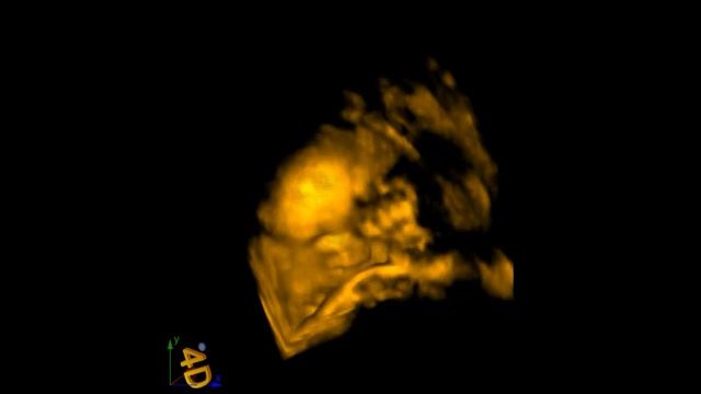 266f2f8d4c99efbdbec46ff330ae03b3