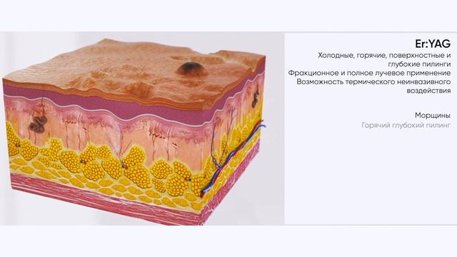 41c5fb18b3d4f42d245e93f58644e27a