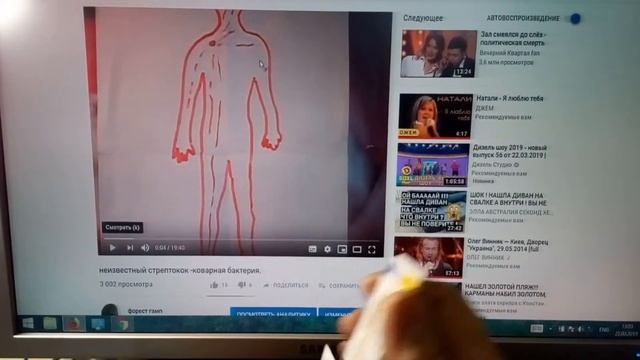 Вздрагивания перед сном,нервно - мышечные прострелы током