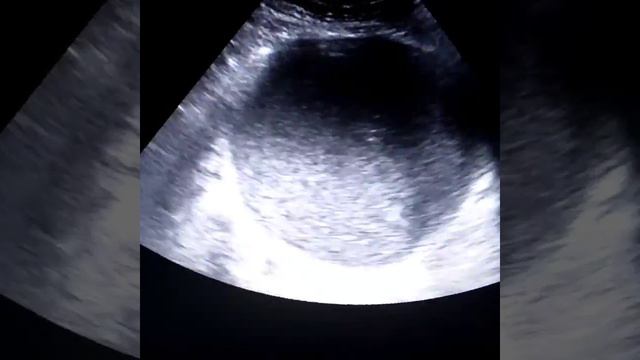 УЗИ мочевого пузыря кота. Мочекаменная болезнь.