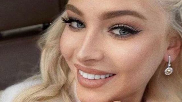 Алена Шишкова призналась, что лысела: «Носила парики. Мне советовали побриться»