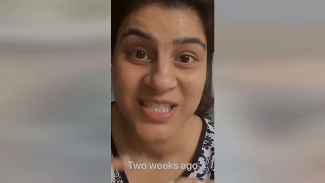 RF Radio Frequency Skin Tightening Lifting For Face And Body Review