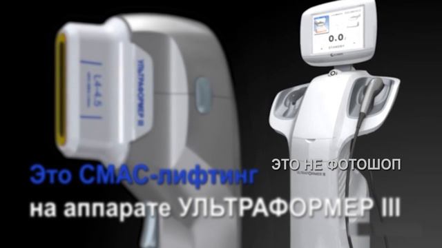 Омолаживаем кожу в Сибирячке с аппаратом ультраформер 3