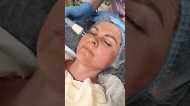 Аппаратная косметология