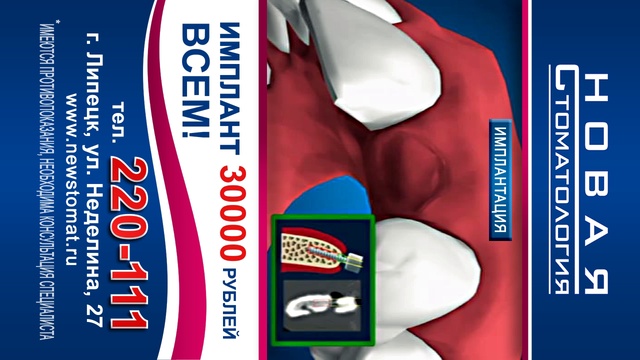 горизонтальный3