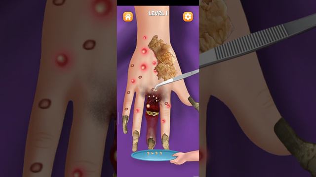 #лечение руки #гной#кольцо#черви#нокти#игра:ASMR FOOT Care:Pedicure Game