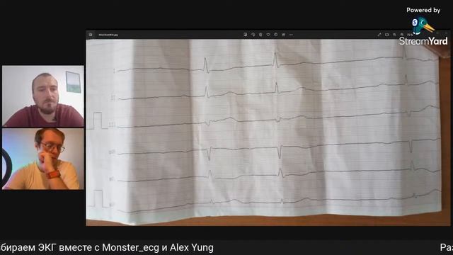 Разбор ЭКГ №7