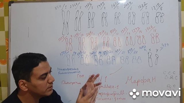 синдром Марфана