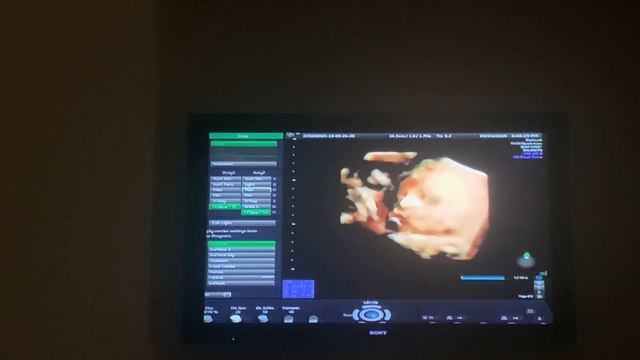 3D/4D ULTRASOUND EXPERIENCE | 31 WEEKS PREGNANT