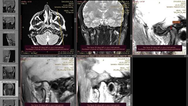 C9e7dfddca6aecc8cebe262a011443bc