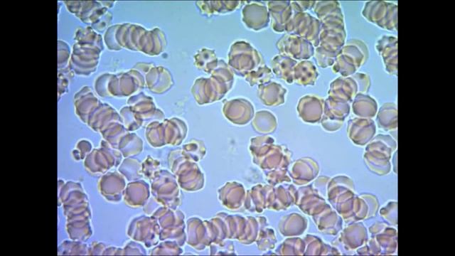 Кровь человека под микроскопом blood under microscope