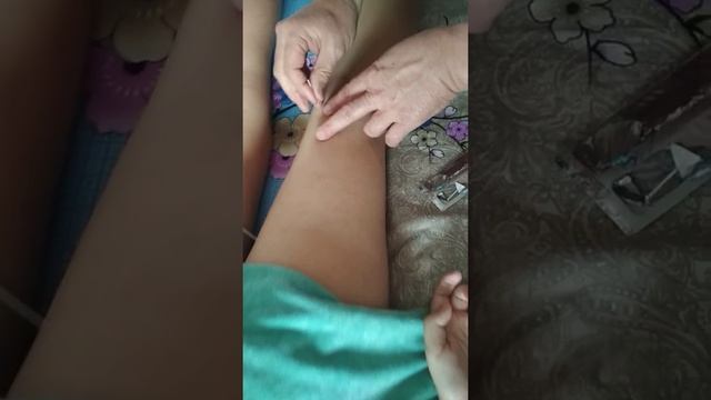 Точечный массаж.Игло укалавания . Кыргызстан город Каракол улица Фрунзе 32 телефон+996972788