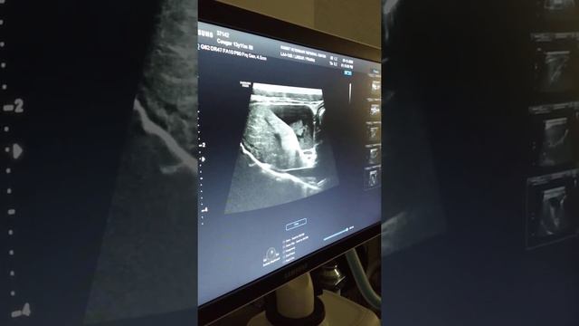 Cougar's Abdominal Ultrasound