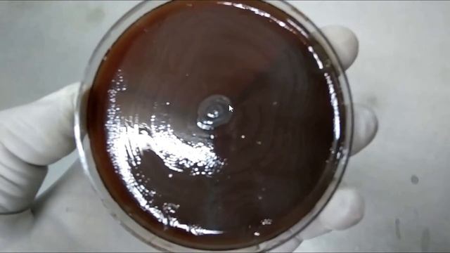 Swarming Of Proteus On Blood Agar  | Swarming Inhibition By Various Methods |Swarming