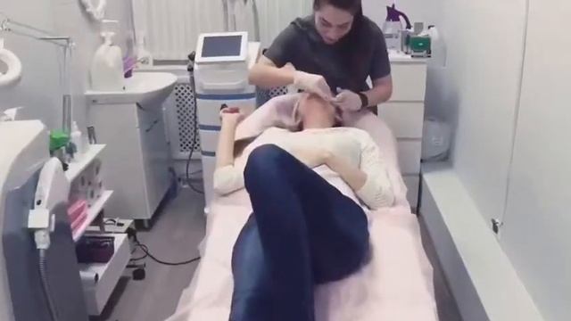 Шугаринг верхней губы