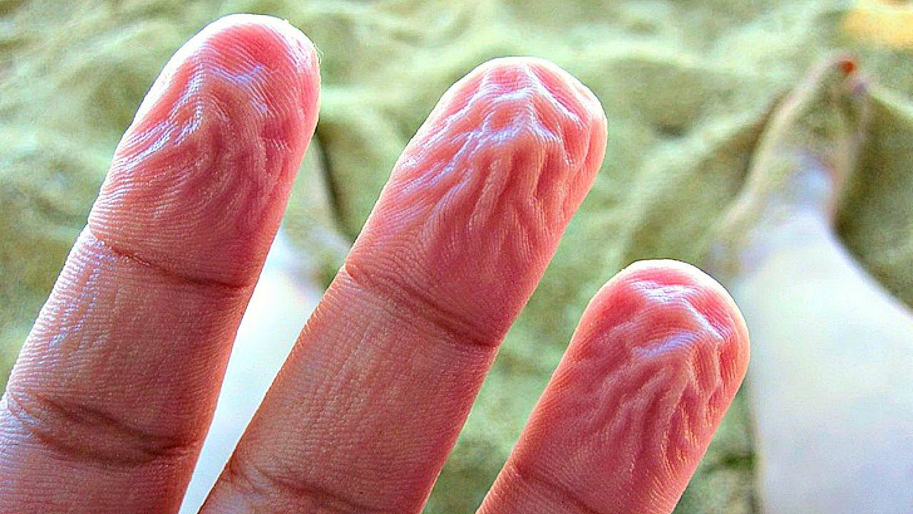 10 ЗАЩИТНЫХ СИСТЕМ НАШЕГО ОРГАНИЗМА