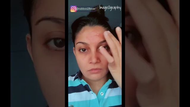 25% AHA, 2% BHA, 5% PHA PEELING SOLUTION//PILGRIM//WORK ON 3 LAYERS OF SKIN//✨??