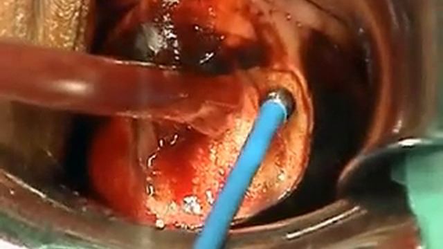 ЛЕВАКОВ LEEP 11´01 v2