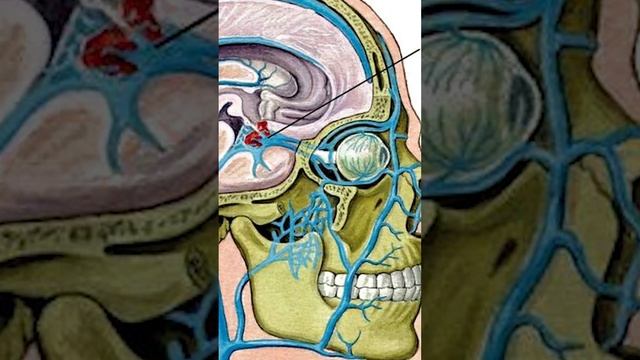 Выдавил прыщ и умер