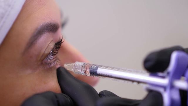 НОСОСЛЕЗНАЯ БОРОЗДА Dr Sitanovich