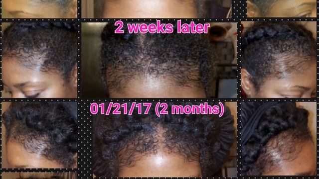 Vitalize Hair Testimonial From Demetris