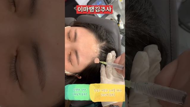 리프팅수술후 관리가 중요한건 아시죠?이벤트 해봅니다 *모든 시술/수술은 부작용이 있을 수 있습니다 #모즈클리닉