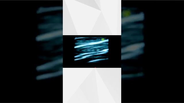 Розинг Борис Львович.mp4