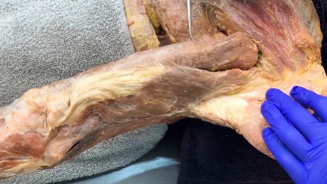 Triceps Brachii   Cadaver   Muscle Anatomy Master Class