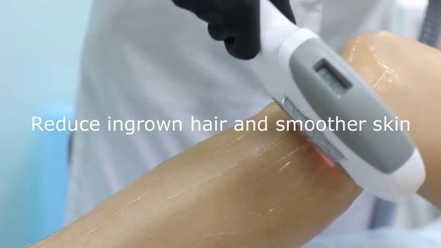 584fe20e2b8e3ee7969324d9385965af