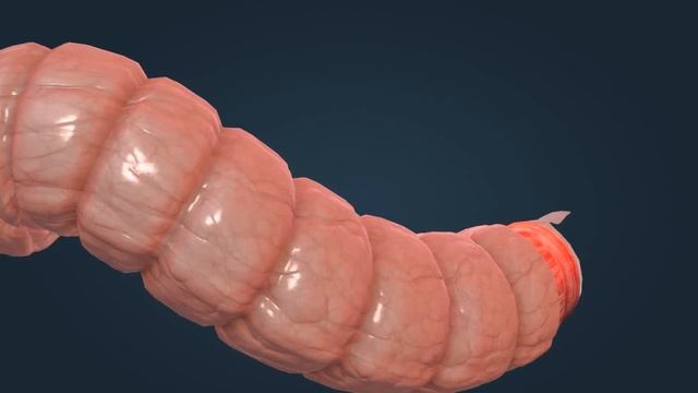 Строение толстой кишки | Анатомия человека | Биология