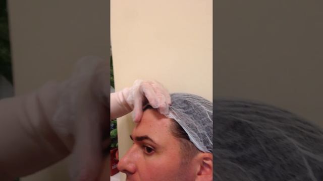 Ботокс обучение практика студента