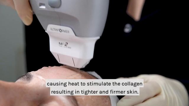 Ultraformer Needling | Skin Lifting, Tightening & Resurfacing
