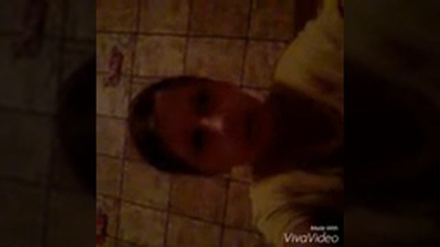 Опухла губа