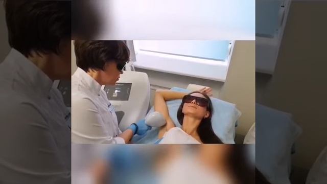 Лазерная эпиляция подмышек