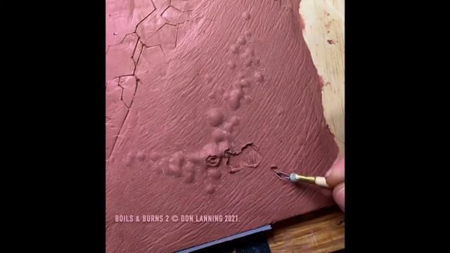 How To Sculpt Boils & Burns - Part 2.