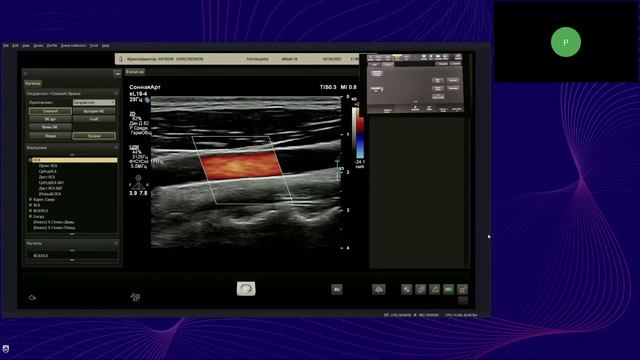 Особенности настройки и проведения исследования внутренних органов на УЗ-системах EPIQ, Affiniti