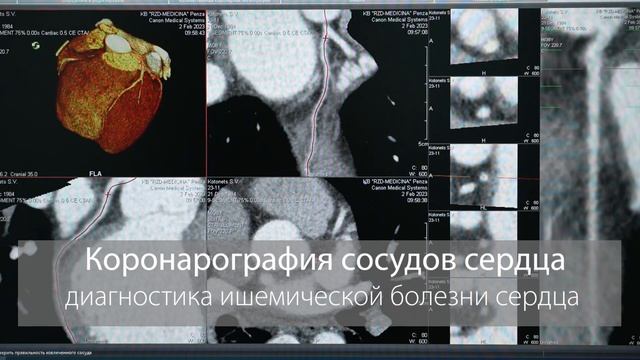 КТ Коронарография в «РЖД Медицина» в г  Пенза