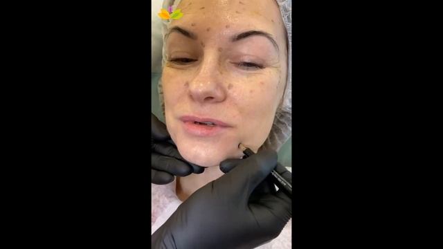 Преображение. 4 серия