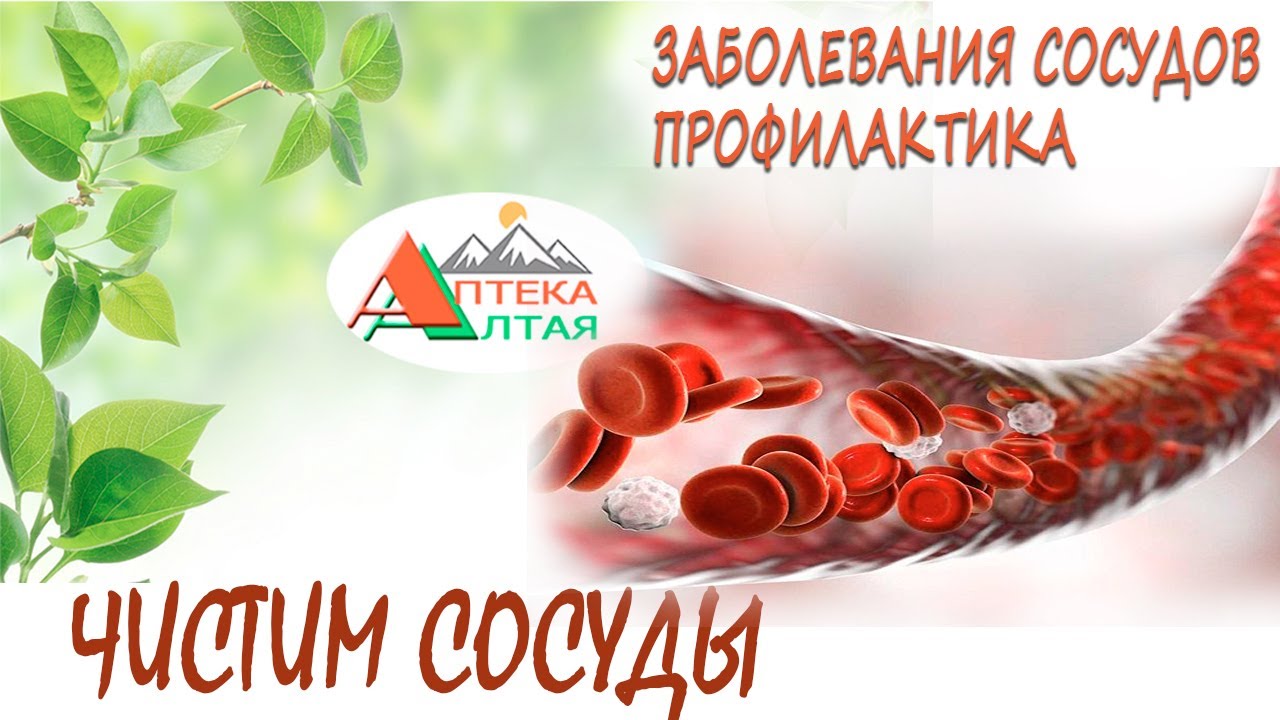 Чистим сосуды