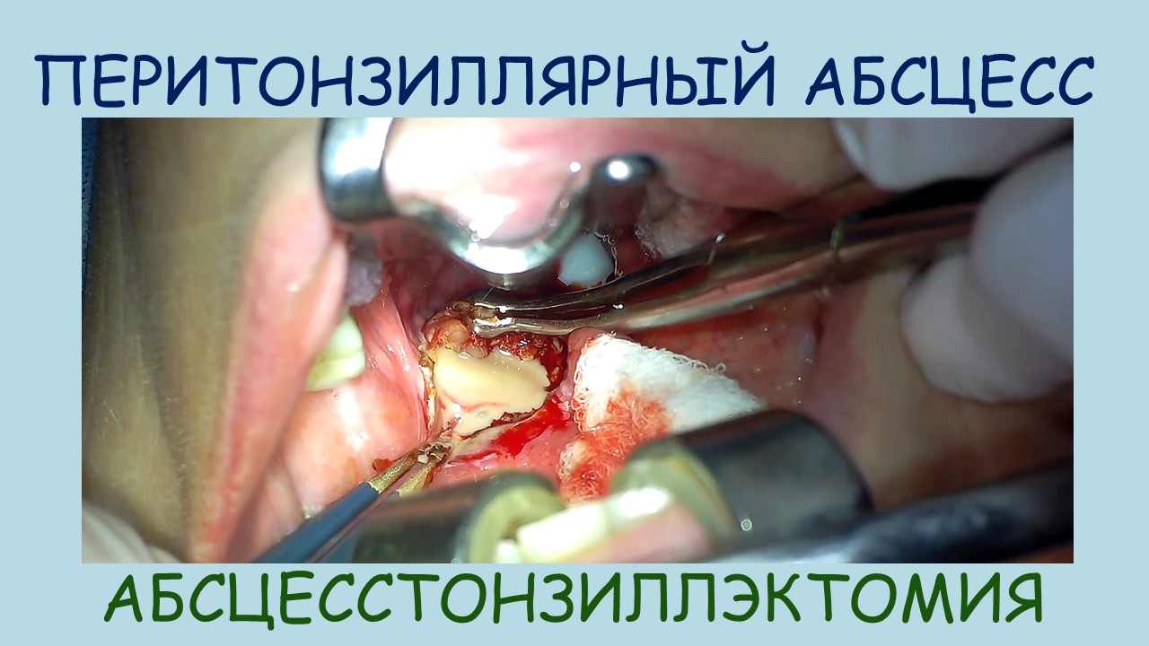 5982f23b6c166d919960ba69d3139a9a