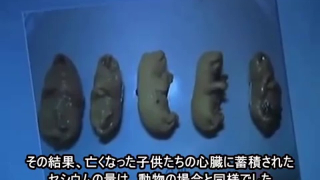 チェルノブイリの被害者は100万人 