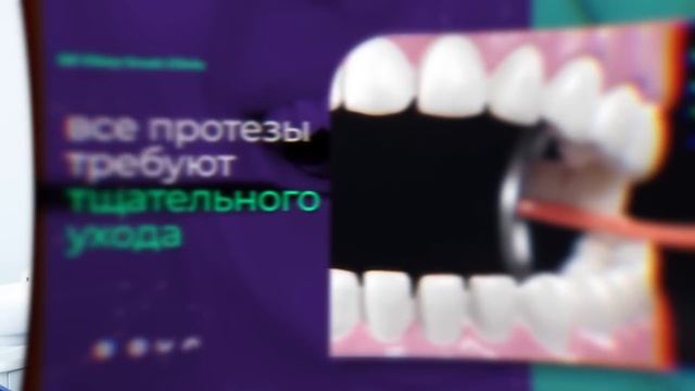 НИКОГДА не устанавливай ТАКИЕ протезы! ГЛАВНАЯ ошибка большинства..