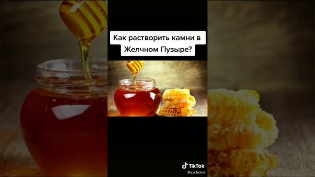 дробление камней в желчном пузыре